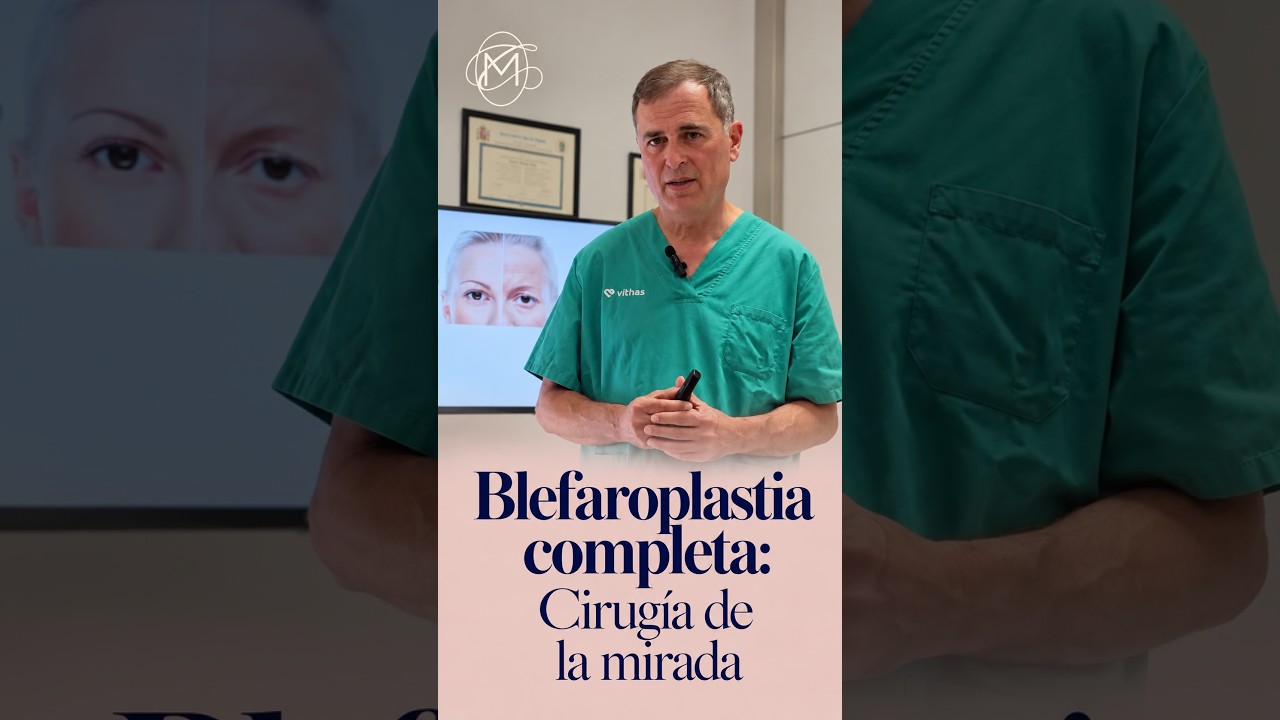 Vídeo sobre blefaroplastia integral y Cirugía de la Mirada en Alicante