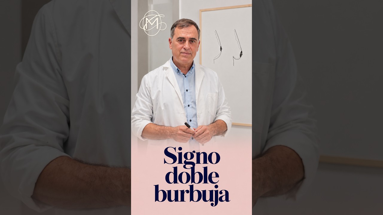Vídeo del Dr. Carlos Laredo sobre el signo de la doble burbuja en el aumento de pecho
