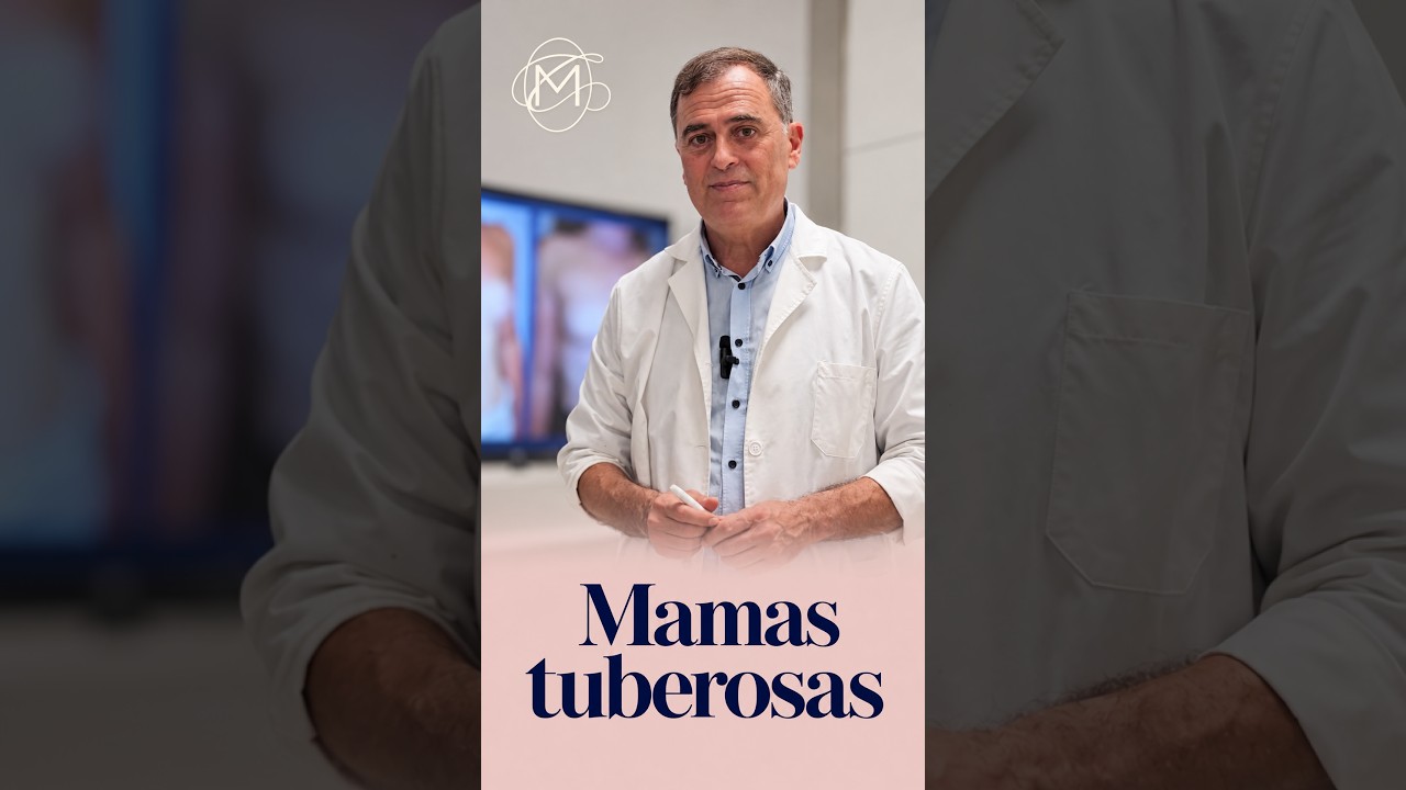Vídeo del Dr. Carlos Laredo sobre las mamas tuberosas